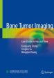 Bone Tumor Imaging For Cheap