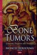 Bone Tumors Sale