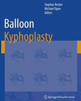 Balloon Kyphoplasty Online Sale